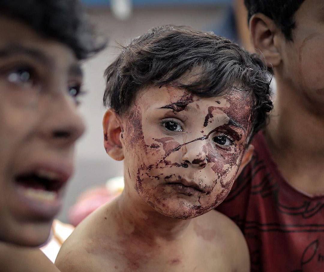 الوجع ليس شرطاً أن يكون بكاء ربما يدعو عليك شخص مظلوم فتكون حياتك أوجاعاً احذروا أن تظلموا أحداً  ... لا حول ولا قوة الا بالله.. فيارب انصر اهلنا الفلسطينين واحرسهم بعينك التي لاتنام