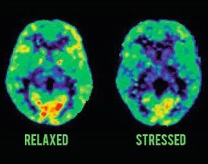 20 Ways To De-Stress Your Life: