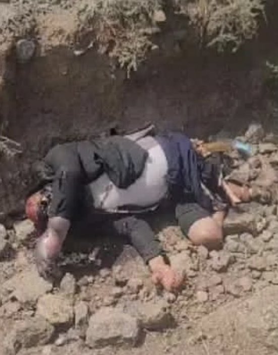 جريمه حوثيه بشعه قتل وطعن وقطع ارجل واذان وفقع عيون وصب اسيد على الوجه وكل انواع الجرائم في ان واحد 

انهم ذئاب بشريه بل وافضع من الذئاب تامروا على مواطن وقتلوه بكل انواع القتل الوحشي  لانه فقط انتقد ظلمهم وطغيانهم ولايحمل اي سلاح فقط سلاح الكلمات

انها جريمة جديدة لميليشيا