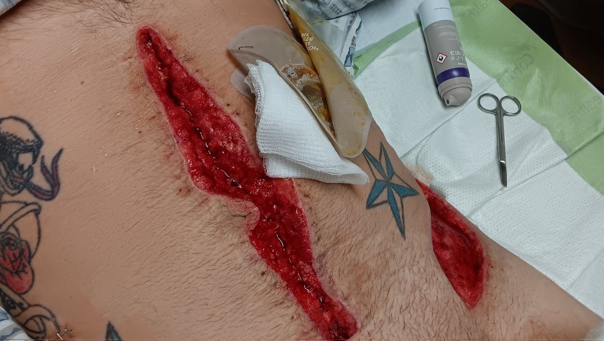 Please support my GoFundMe campaign: gofund.me/b2906f4b #GoFundMe