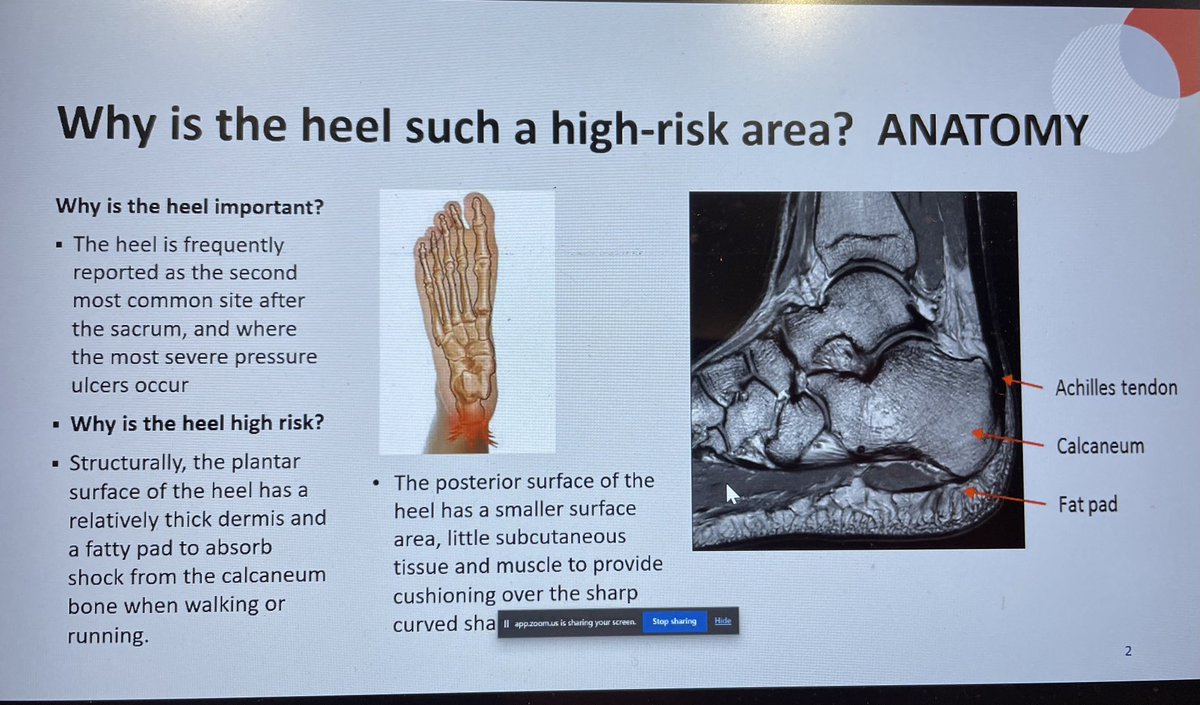 Great presentation ⁦@SoTV_UK⁩ advanced #pressureulcer study day today from Dr Clare Greenwood on why the heel is such a high risk area. Her presentation will be available on our website if you missed the session. #StopThePressure