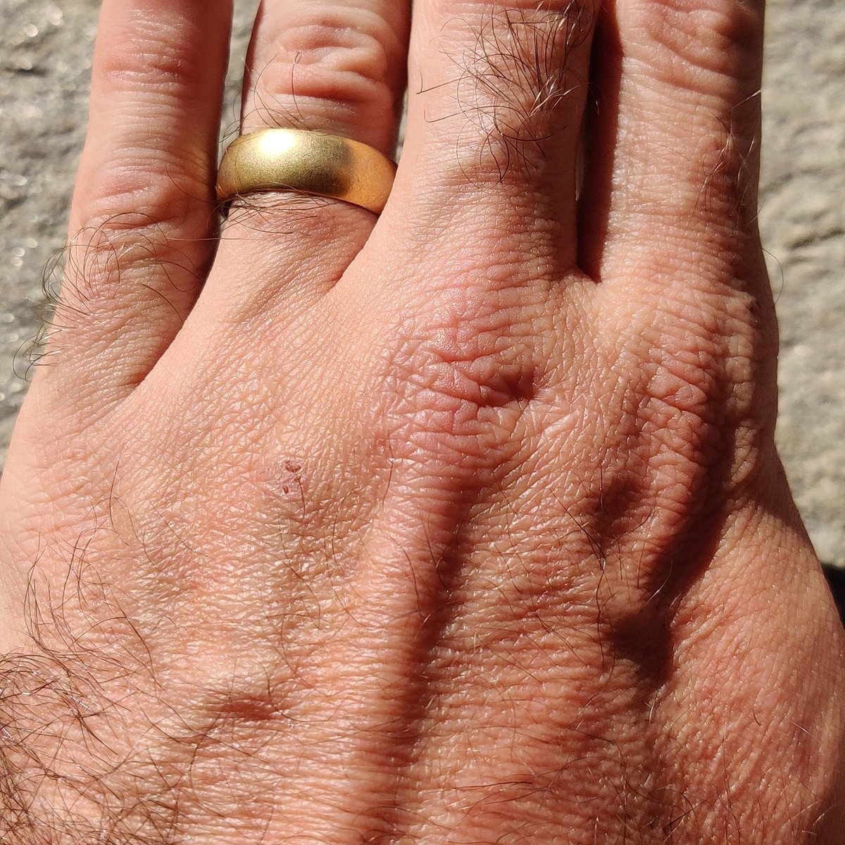 Matthew Tarling tweet media