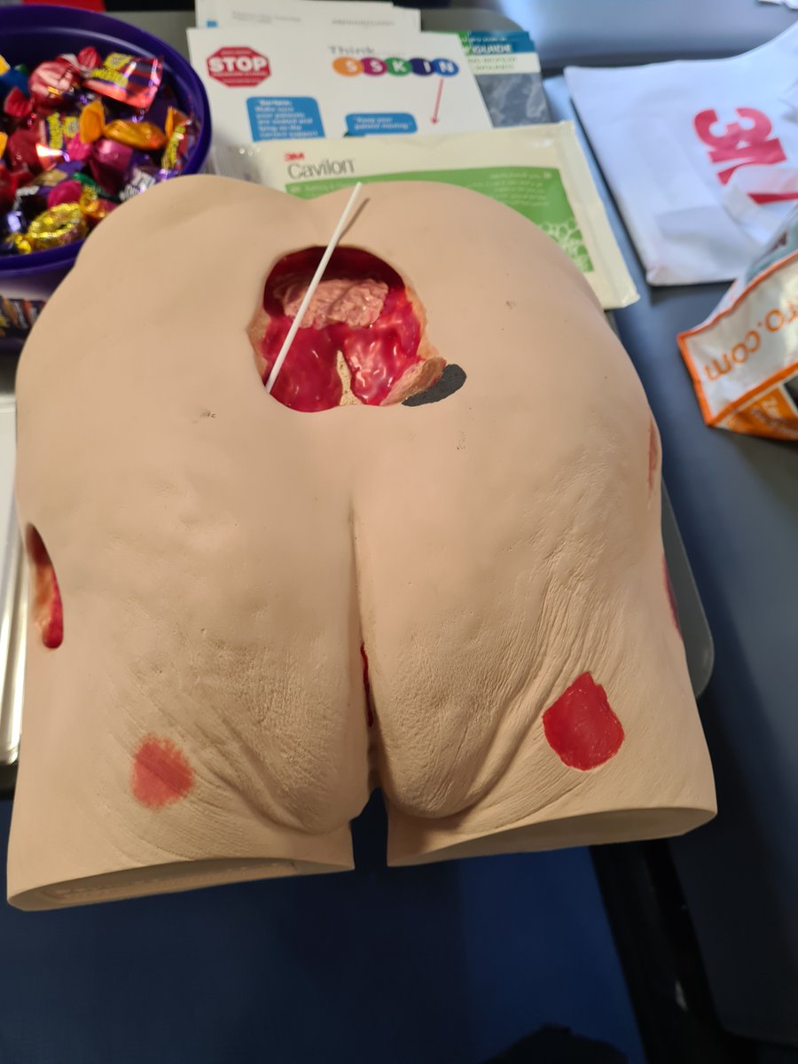 UHW_Waterford's tweet photo. In UHW today we had the TVN's out in force for International STOP Pressure Ulcer/ Injury Day #helpraiseawareness of #pressureulcers #patientsafety @HSELive @SouthEastCH @NationalQPS https://t.co/EjYP8MKw2l