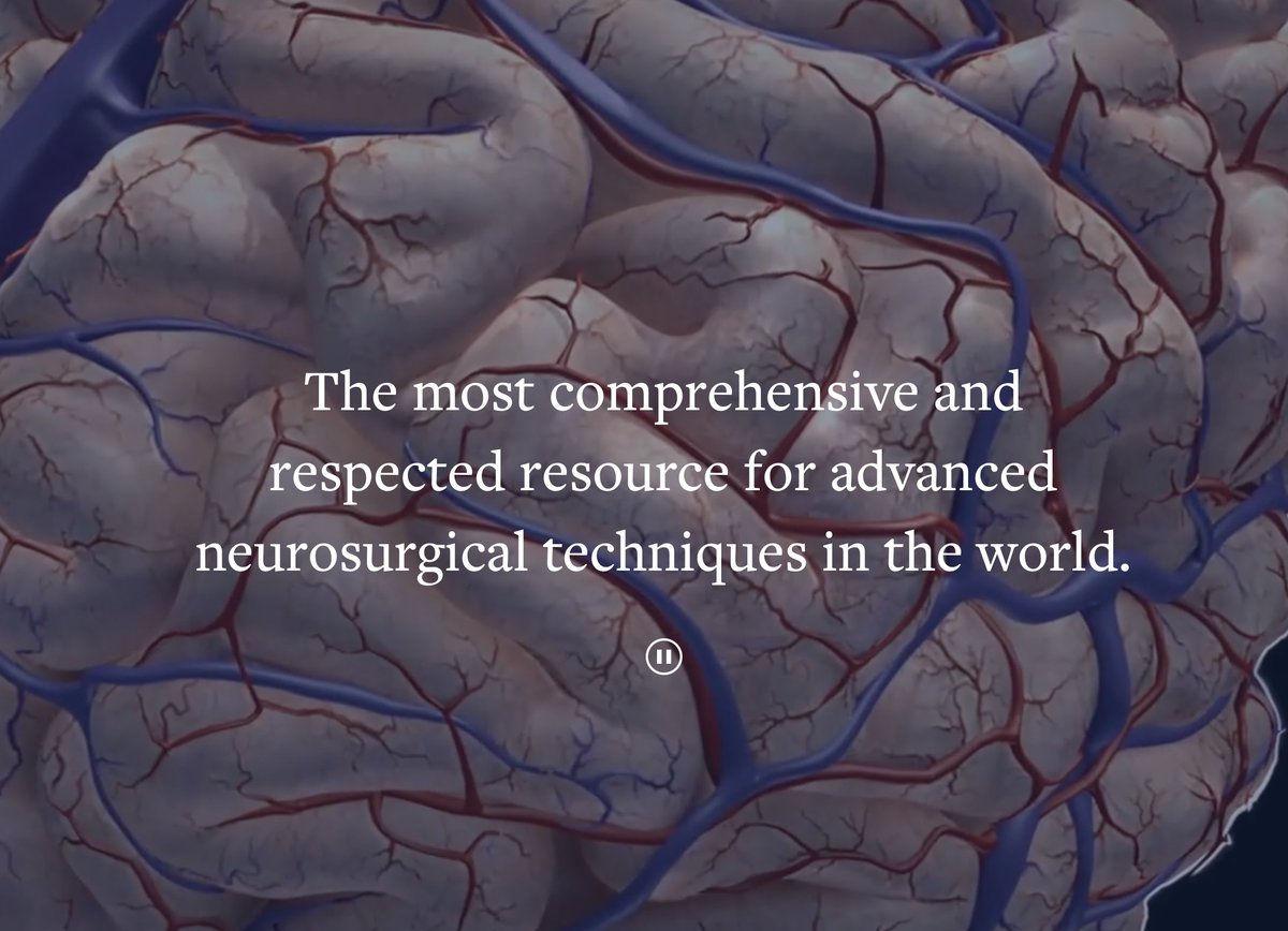Thrilled to announce my surgical case videos are now featured in "The Neurosurgical Atlas" Master Cases, alongside Dr. Spetzler and Dr. Couldwell. Grateful for the opportunity to contribute to neurosurgical education.  #Neurosurgicalatlas #MedicalEducation #Neurosurgery