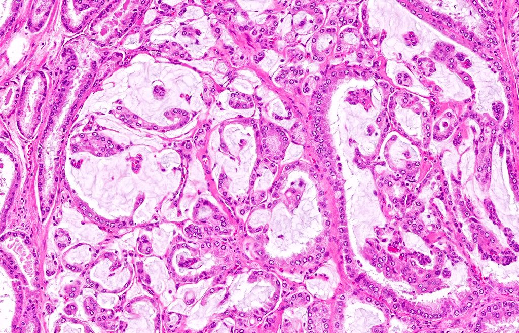 Katrina Collins, MD || Pathologist tweet media