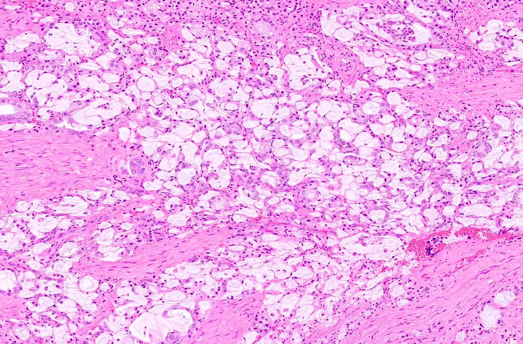 Katrina Collins, MD || Pathologist tweet media