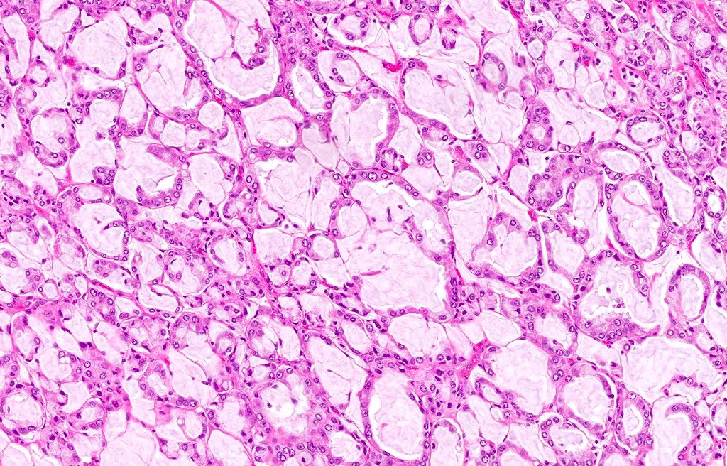 Katrina Collins, MD || Pathologist tweet media