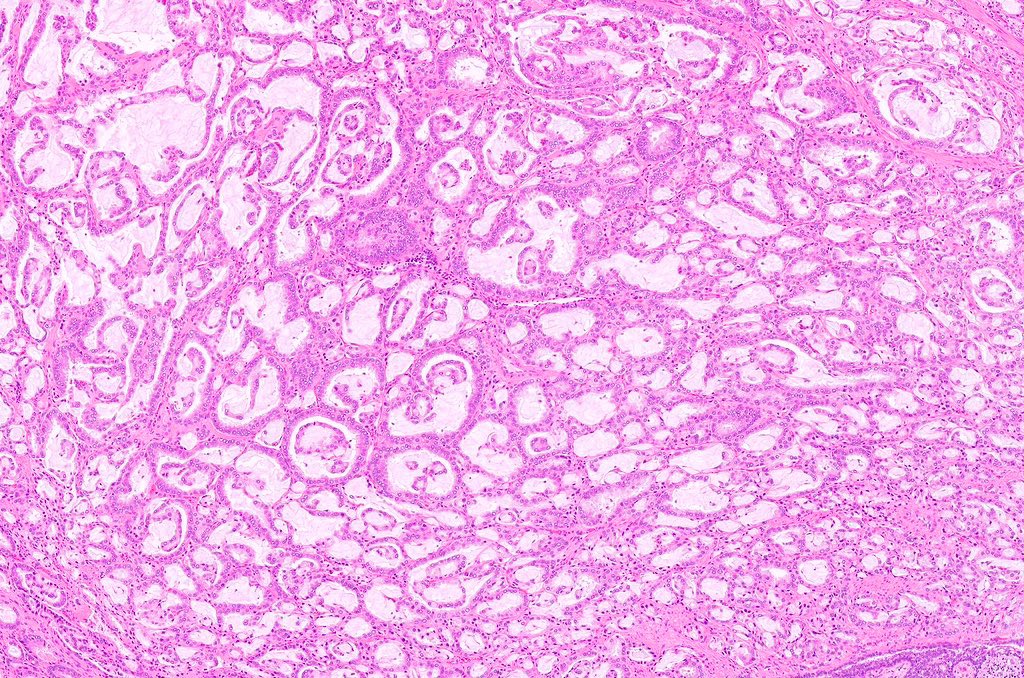 Katrina Collins, MD || Pathologist tweet media