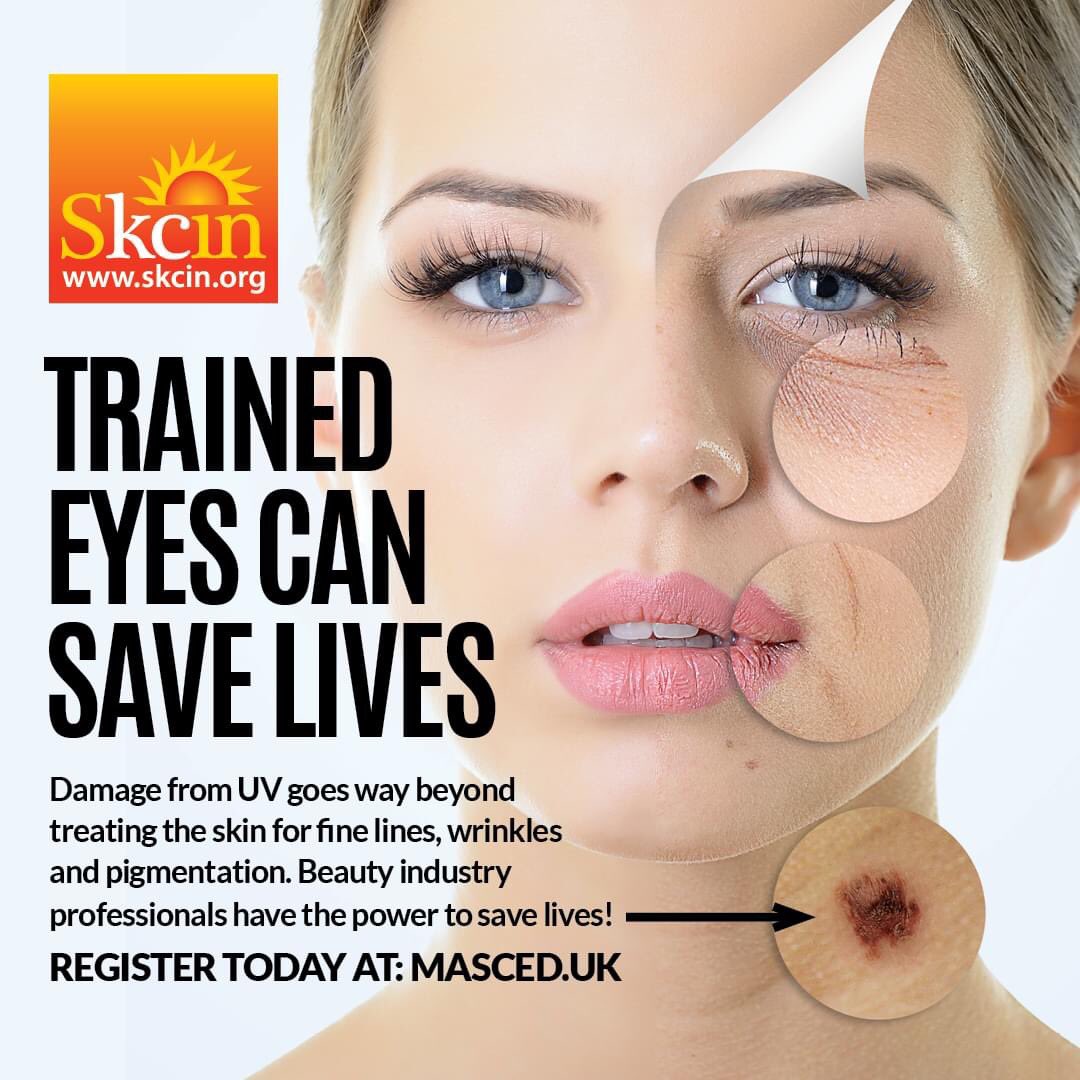SkcinCharity's tweet image. Work in the beauty industry? 1 in 4 men &amp;amp; 1 in 5 women in the UK will develop skin cancer - do you know how to spot the early warning signs?
Skin cancer is the most common cancer in the UK &amp;amp; worldwide! Beauty industry are therefore uniquely placed to identify suspicious lesions…