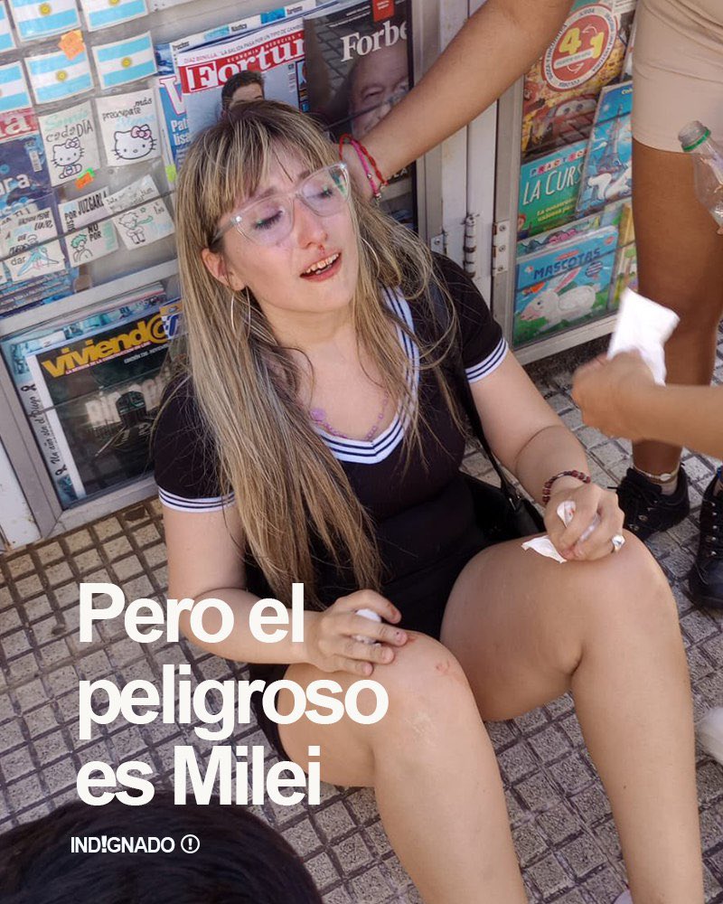 Atacaron salvajemente a una chica de La Libertad Avanza que repartía boletas de Milei. Así la dejaron los militantes del amor Massa. Ah pero las mujeres están en peligro si gana Milei. Compartí al máximo para que todo el mundo vea como son los kirchneristas. 🧨💥