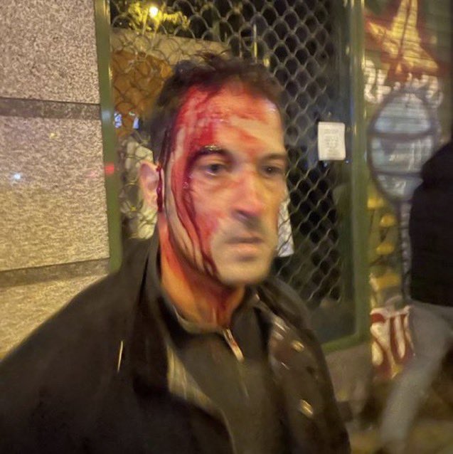 ¡ Ketchup eso es Ketchup !
¿No saben ya como manipular y mentir más esta gente?

Son puro teatro 

¿A que jode?