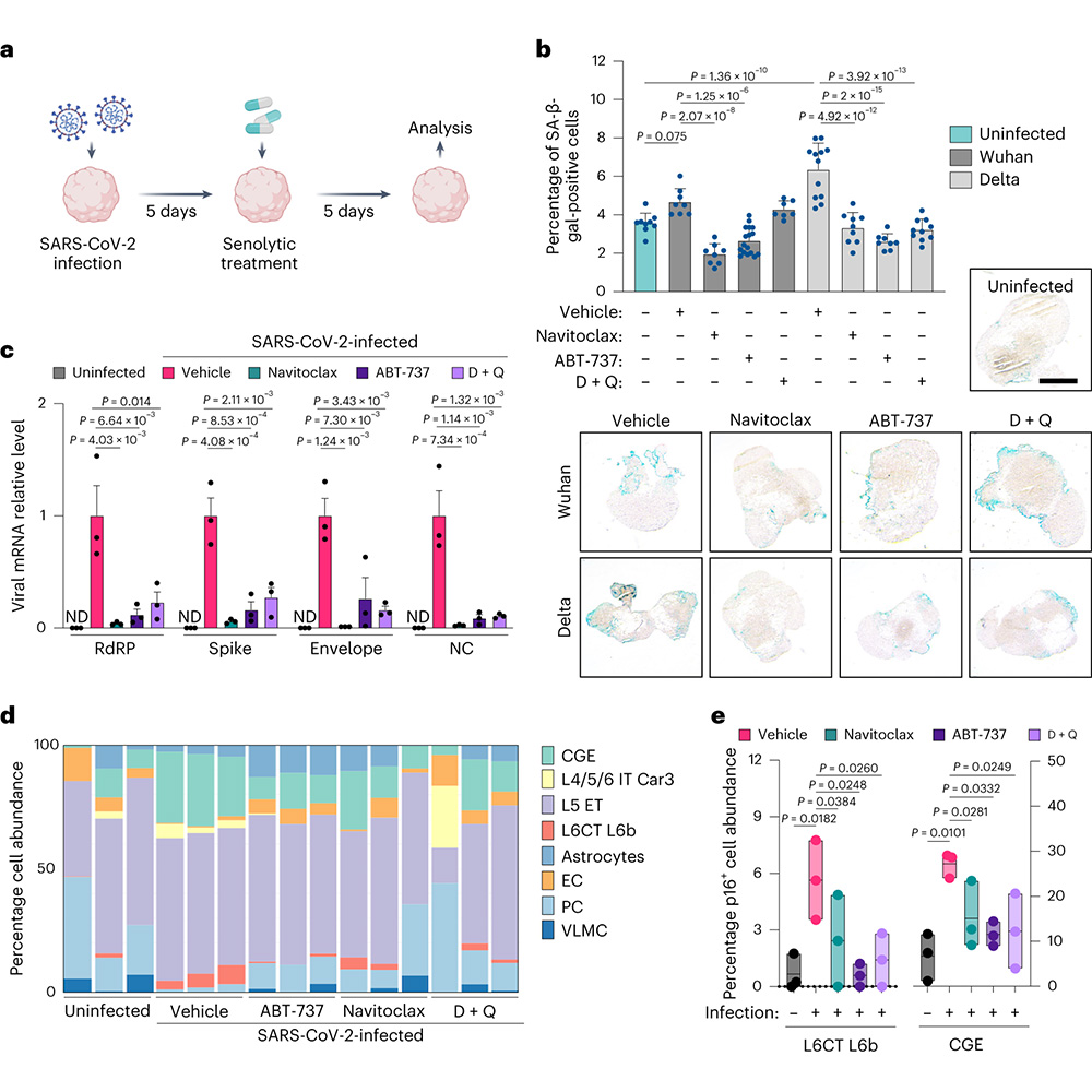 Nature Portfolio (@natureportfolio) on Twitter photo A study in <a href="/NatureAging/">Nature Aging</a> shows that SARS-CoV-2 induces senescence in human brain organoids and in the brains of infected mice and humans and demonstrates the therapeutic potential of senolytic therapy in protection against COVID-19-induced brain aging. go.nature.com/3QEcsVu A study in <a href="/NatureAging/">Nature Aging</a> shows that SARS-CoV-2 induces senescence in human brain organoids and in the brains of infected mice and humans and demonstrates the therapeutic potential of senolytic therapy in protection against COVID-19-induced brain aging. go.nature.com/3QEcsVu