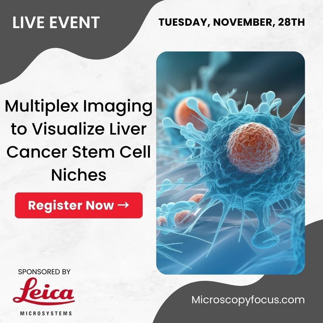 BitesizeBio's tweet photo. Study #tumormicroenvironments in amazing detail 🔬🤩. See how #multipleximaging can reveal #tissue landmarks, intratumoral structures & #extracellularmatrix #proteins associated with #livercancer. @LeicaMicro #CancerResearch #Microscopy 🖊️ Register now → https://t.co/B6x6RxYckQ https://t.co/GHbMTbvqD0