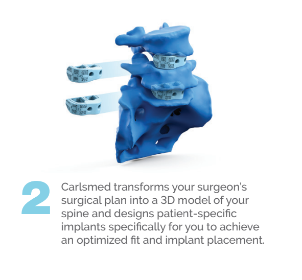 carlsmed's tweet photo. Using patient imaging and digital technologies, aprevo® provides personalized surgical plans and patient-specific implants to help your surgeon achieve the desired correction during surgery. Learn how it works:

#Carlsmed #aprevo #PersonalizedSurgery https://t.co/IZLjIDOzzr