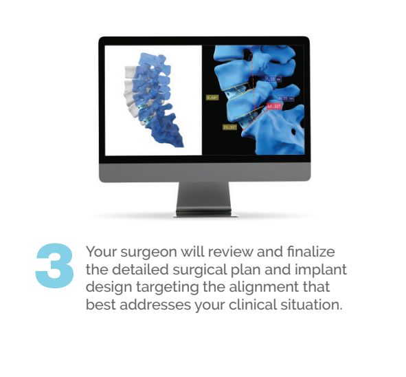 carlsmed's tweet photo. Using patient imaging and digital technologies, aprevo® provides personalized surgical plans and patient-specific implants to help your surgeon achieve the desired correction during surgery. Learn how it works:

#Carlsmed #aprevo #PersonalizedSurgery https://t.co/IZLjIDOzzr