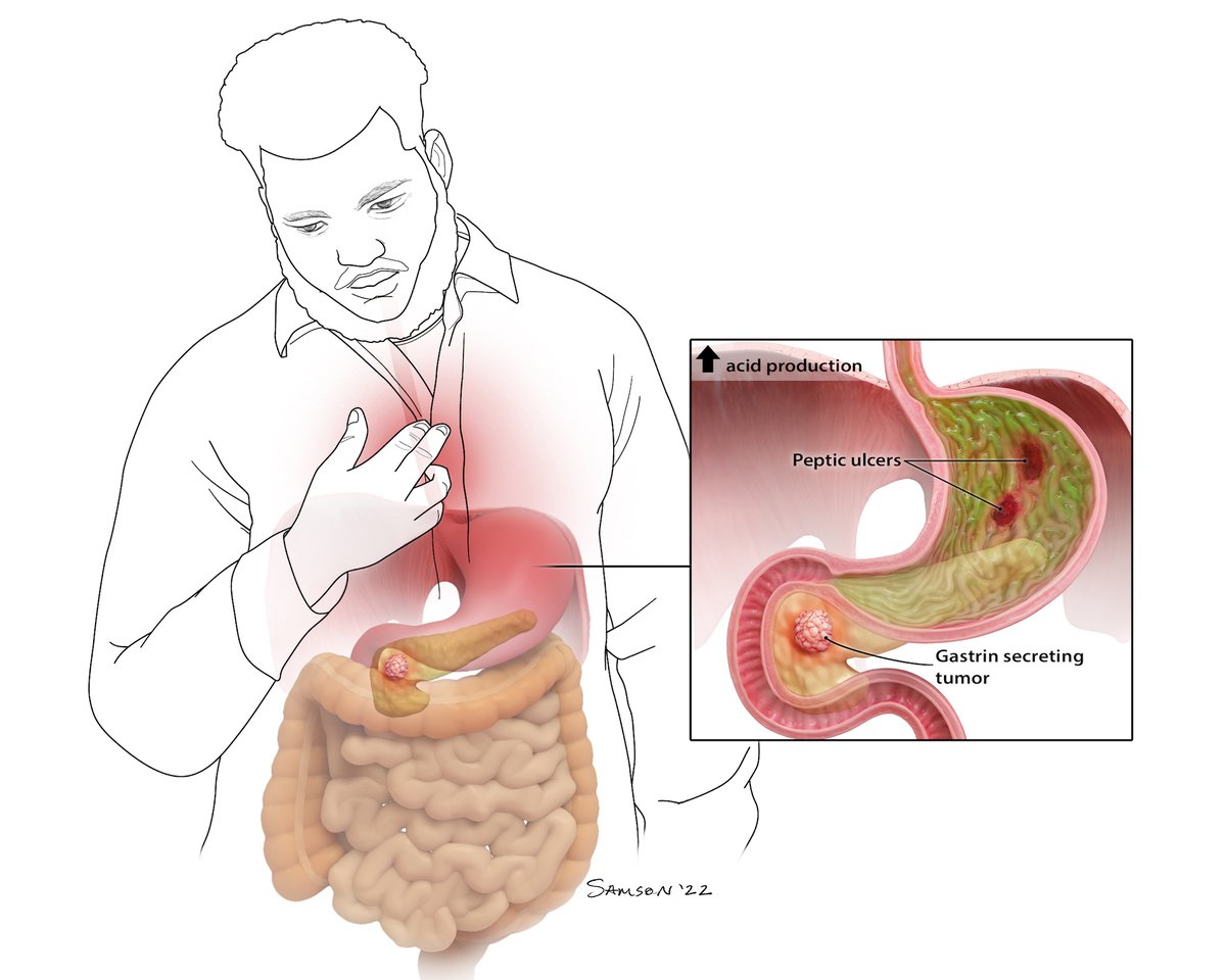 yosef_skampson's tweet photo. Really pleased to receive 4 awards of merit at the 2023 BioImages Awards. So many awesome illustrations, photos and interactives, check out the exhibition and award winners https://t.co/zSdR8NRxwC
#bioimages #medicalillustration #scientificillustration https://t.co/ZFhfkMEOW8