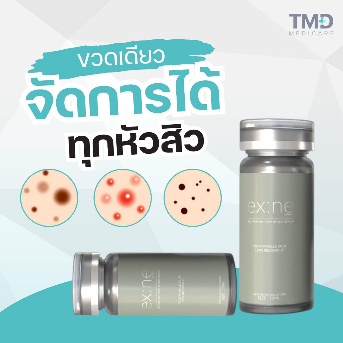 TMDMedicare's tweet photo. 🚩เอ็กเน่เอ็กเน่ โพลีเปปไทด์ ดีพ รีแพร์  เซรั่ม 
ขวดเดียว จัดการได้ทุกหัวสิว 

ผลิตภัณฑ์ที่คิดข้น เพื่อดูแลปัญหาสิวโดยเฉพาะ
ลดสิวอุดตัน ดีท็อกซ์ผิวหน้า ไม่ทิ้งรอยสิว

เพียง 590.- ขนาด 10 ml.

#สิว #รักษาสิว  #TMDMedicare #Exosome #Growthfactor #exne #tamadaclinic #สิวหาย https://t.co/AzDQGVRlqK