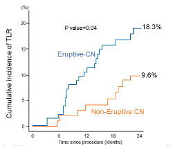 IMPORTANT 👀to understand difference b/w:

ERUPTIVE calcium nodule (CN): disrupted fibrous cap w/ clots

vs

NON-eruptive CN: smooth intact fibrous cap w/o clot

➡️Eruptive easier to expand (Fig 1 vs 2), BUT outcomes far worse (Fig 3). Fantastic paper!

jacc.org/doi/10.1016/j.…