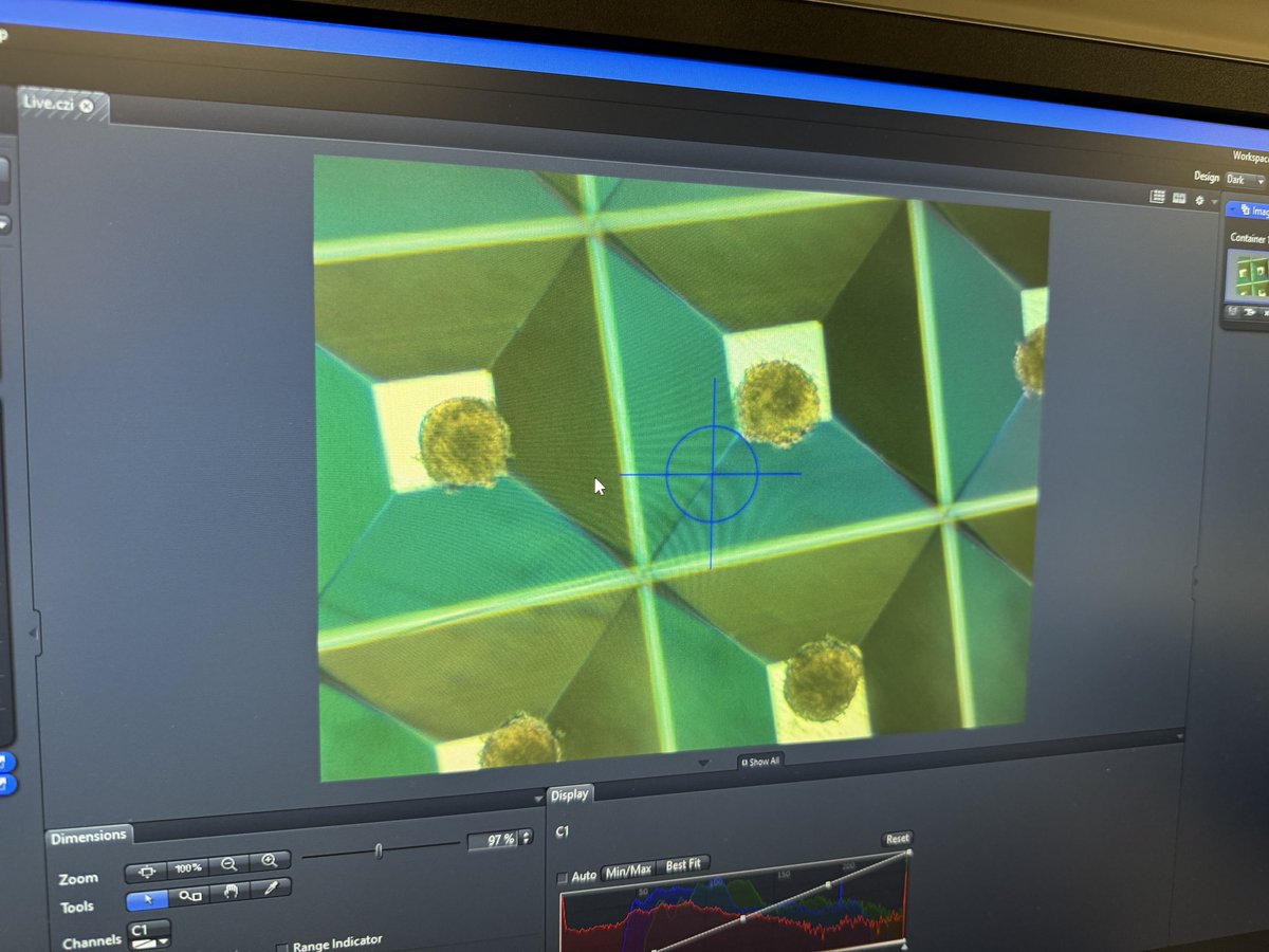 MrArsenie's tweet photo. Day 2 on #ReproSTEM with Dr. @mmlaronda @LurieChildrens yesterday was beyond insane! Being back in the lab, working with testicular tissue, seeding cells to build and manipulate organoids to learn about eventual IV sperm production..beyond awesome. @network14cps @CarlSchurzHS https://t.co/XQV5D2XrW0