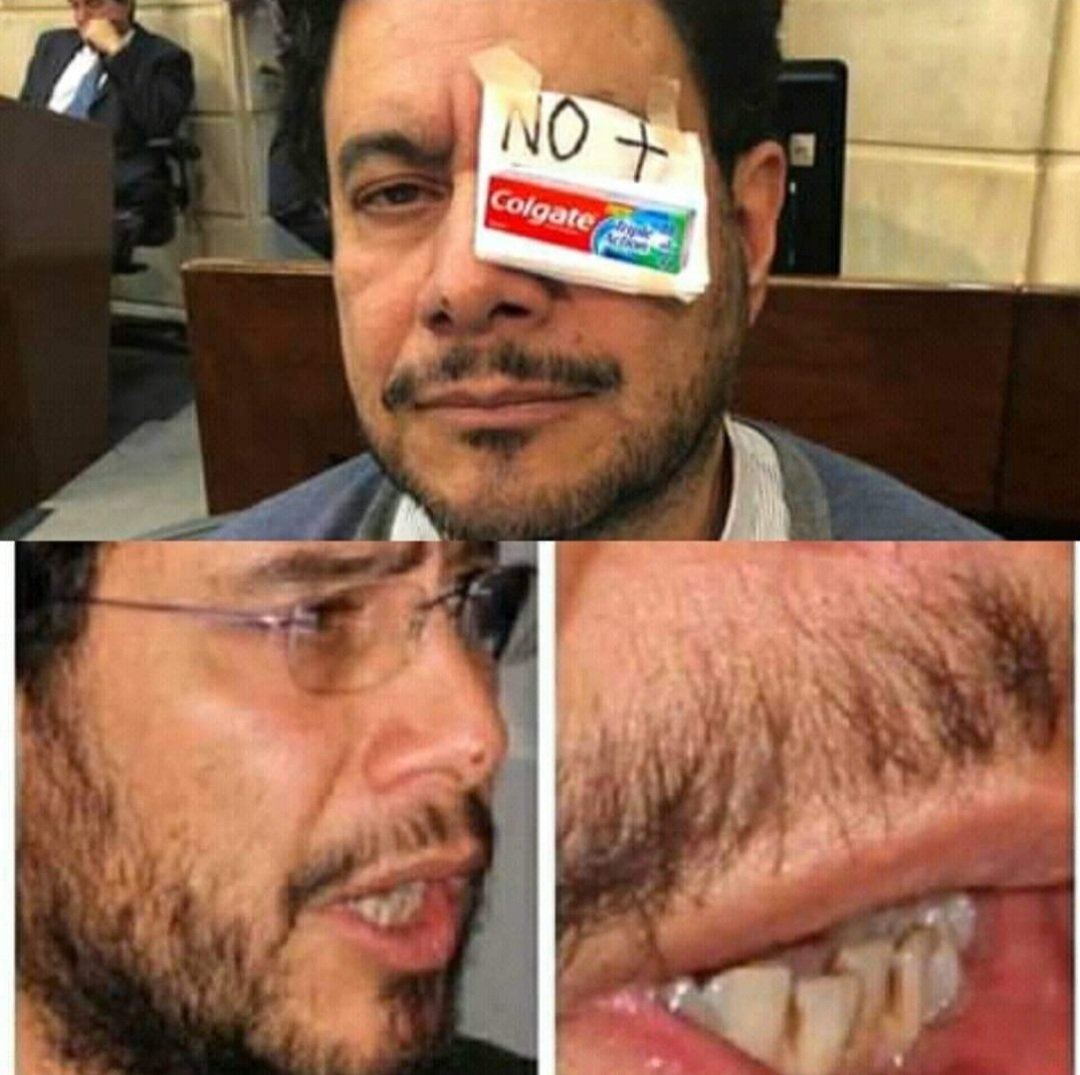 jimitucker1's tweet photo. ESE DESGRACIADO MUGROSO 🧻MISERABLE DIENTIPODRIDO #DENTIX 🦷 @IvanCepedaCast 🚽ESTA #CARIES 🦷Y TODA SU FARSA CAERÁ🚽BOLA DE MUGRE😷 Y A LA CARCEL O EN EL INFIERNO 🔥TERMINARAS MALDITO #PIOJOSO 🪰#APESTOSO 🪰😷 #SenadorDeFarc #MugrosoCepeda #DentixCepeda #CepedaGuerrillero https://t.co/UdizuQVybF