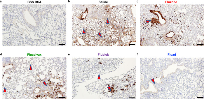fourthdose's tweet photo. #Fluad is almost an #UNIVERSAL Influenza Vaccine, AND it gives 100% protection for mice lungs.
Infectious virus could NOT be recovered from the lungs of mice vaccinated with Fluad, while the other vaccines permitted viral recovery.
Other 3 vaccines tested:
#Fluzone High Dose, #Flucelvax, #Flublok.
Of the 4 vaccines tested, the SECOND best vaccine was FluBlok.
Fluad contains Hemagglutinin #NanoDiscs, this protected mice lungs!
(Fluad contains adjuvant #MF59, but this is not important).
--
In which countries can one buy Fluad vaccine??
Fluad & FluBlok are NOT sold for 2023-2024 flu season in: Finland, Estonia, Sweden.
Although Fluad is in use in Sweden for old people who can’t live alone without help, other people can’t get it even with money. Google search:
"fluad" site:.se pris OR prislista

#Flu #Influenza #InFluensa
#Vaccine #vaccination #Vaccin
#Tukholma #Stockholm #Ruotsi #Sverige
#NanoDisc #Hemagglutinin
#influenssa #influenssarokote #influenssarokotus

@erictopol