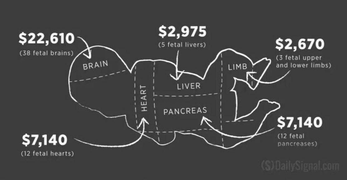 Abortion is big business. The later the term, the more $ is made. Humans are merely farm animals to the elite.