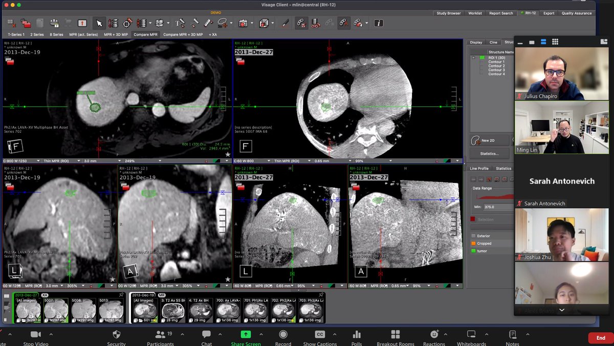 Great <a href="/YaleBme/">Yale BME</a> teaching session by <a href="/MingDeLin1234/">Ming Lin</a> on Image Post-Processing, elegantly demonstrated with the <a href="/Visage_Imaging/">Visage Imaging</a> platform.