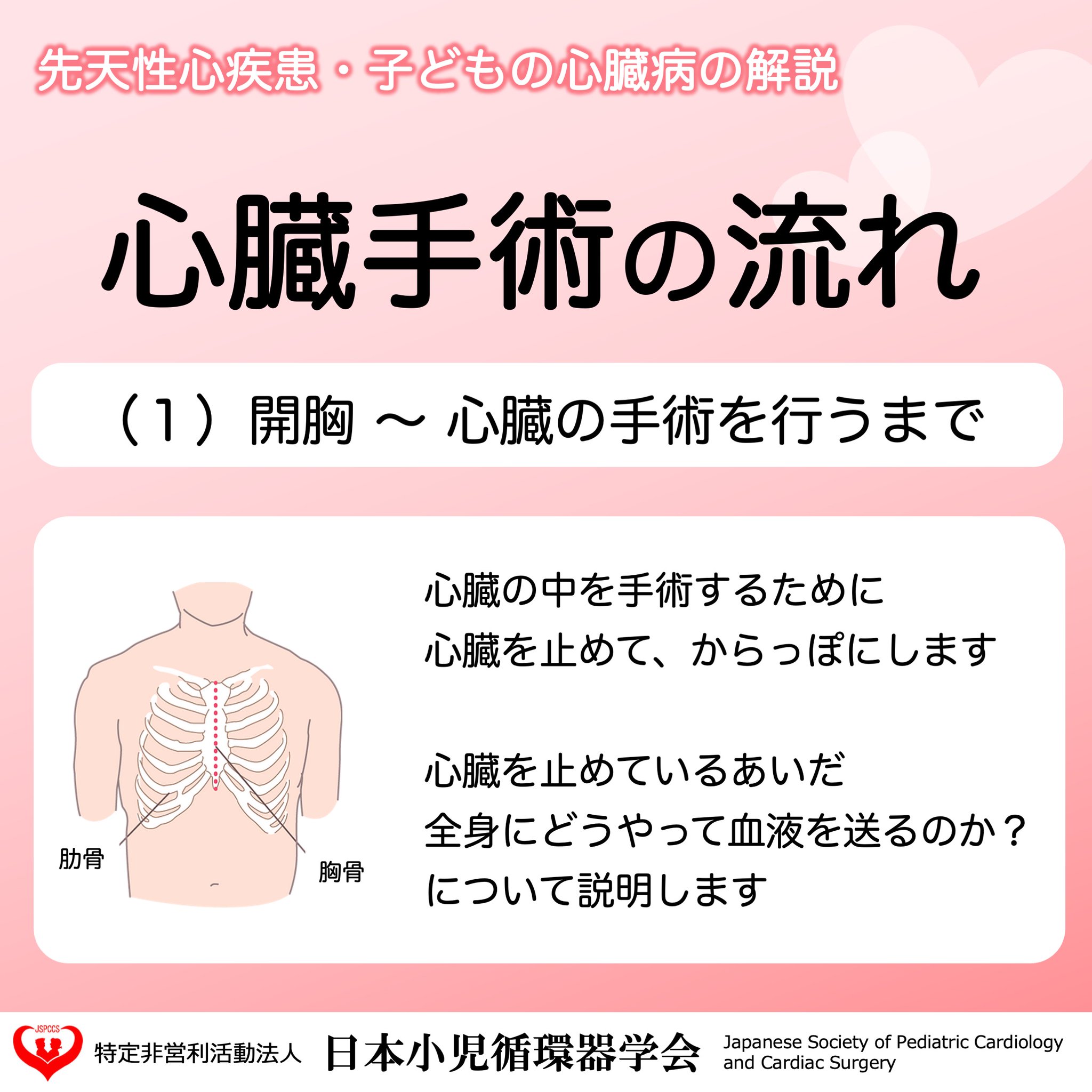 日本小児循環器学会【公式】 on X: 日本小児循環器学会【公式】 on X: