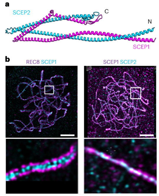 NaturePlants's tweet photo. New Article: "SCEP1 and SCEP2 are two new components of the synaptonemal complex central element" https://t.co/63IdDsj1EU

With Research Briefing: "The plant synaptonemal complex: identification of the first central element components" https://t.co/EeLaRfrKiH https://t.co/LmfUIhzPjc