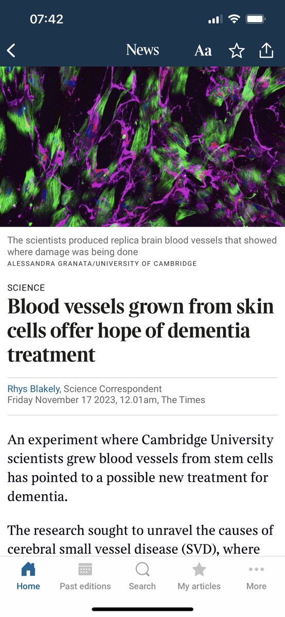 Coverage of our article in ⁦⁦<a href="/stemcellreports/">StemCellReports</a>⁩ in Times today. Modelling small vessel disease, major cause of #dementia, in a dish using IPSC cells. Exciting findings pointing the way to new treatments ⁦<a href="/DrAlexGranata/">Alex Granata</a>⁩ ⁦<a href="/CamNeuro/">Cam Neuroscience</a>⁩ ⁦<a href="/Cambridge_Uni/">Cambridge University</a>⁩