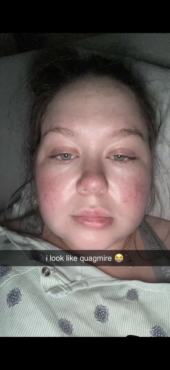 mcbridemc23's tweet photo. going through pictures from having marlow and found this one while I was on mag drip for preeclampsia and it’s so funny im so glad i took it https://t.co/9WXXaJHK2C