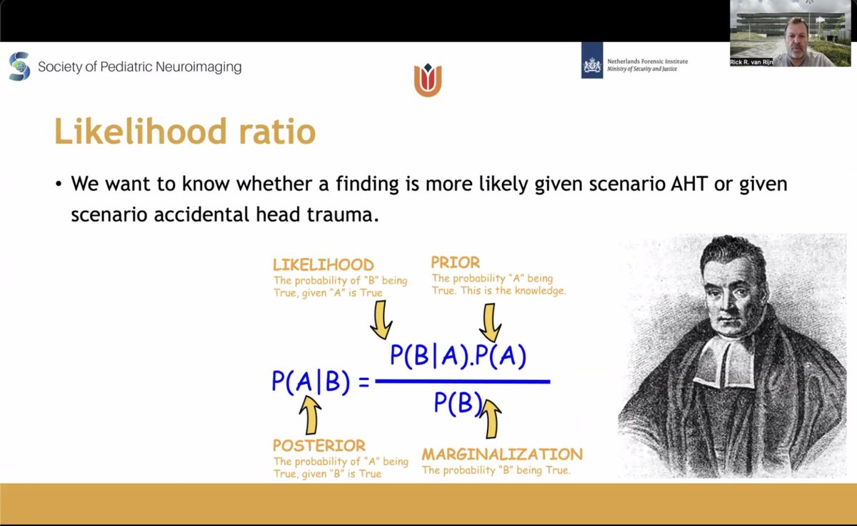 spinacademics's tweet image. Thrilled to have Dr. Rick van Rijn from the Netherlands deliver an insightful talk on Abusive Head Trauma. His expertise illuminated crucial aspects of this challenging topic, sparking valuable discussions. #SPIN2023