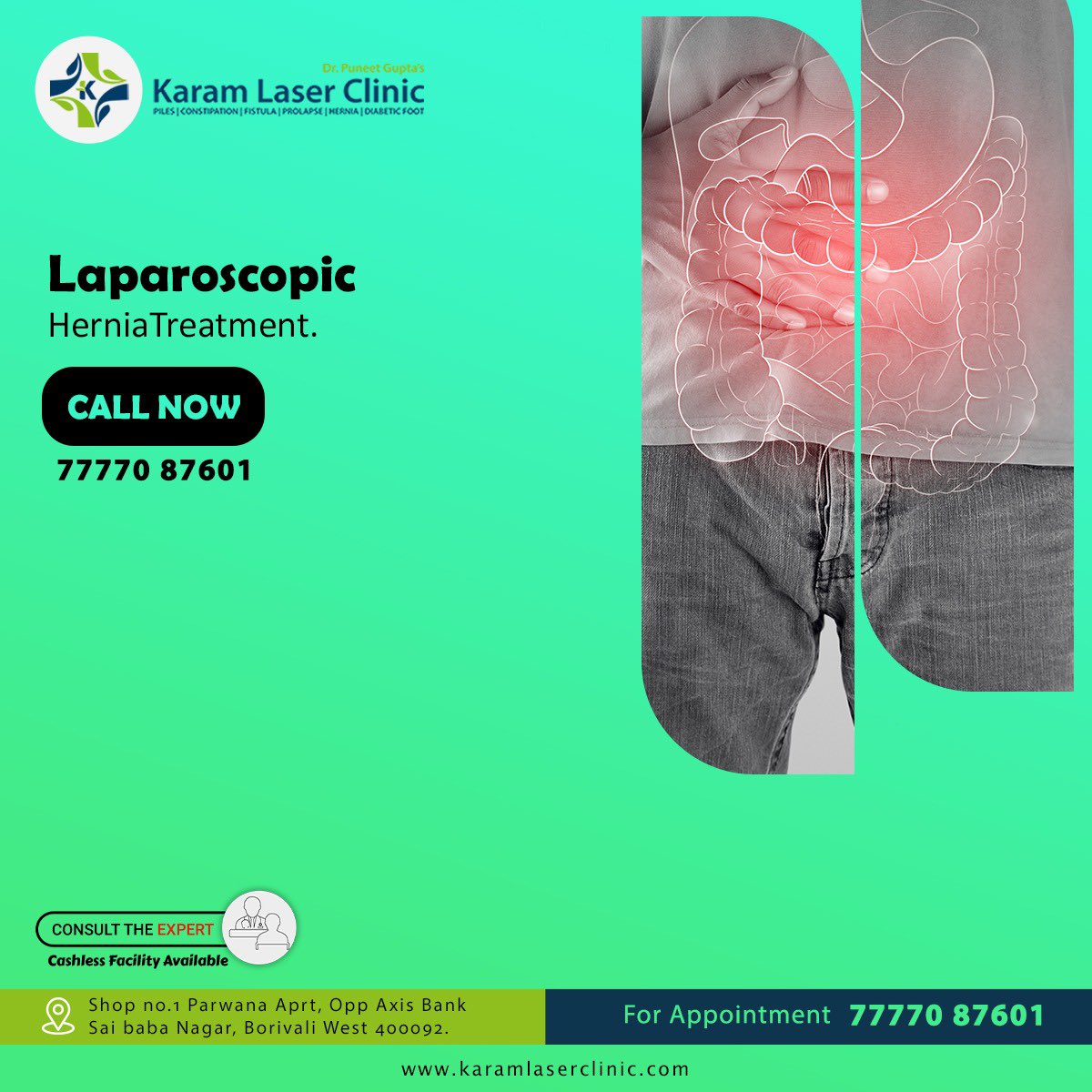 Laparoscopic Hernia Surgery.

Dr.Puneet Kumar Gupta
Laser and Laparoscopic Surgeon
(PILES | FISSURE | FISTULA | HERNIA | GALLBLADDER.

#piles #pilestreatment #PilesSurgery #fissuresurgery #fistulasurgery #gallbladdersurgery #gallbladderremoval