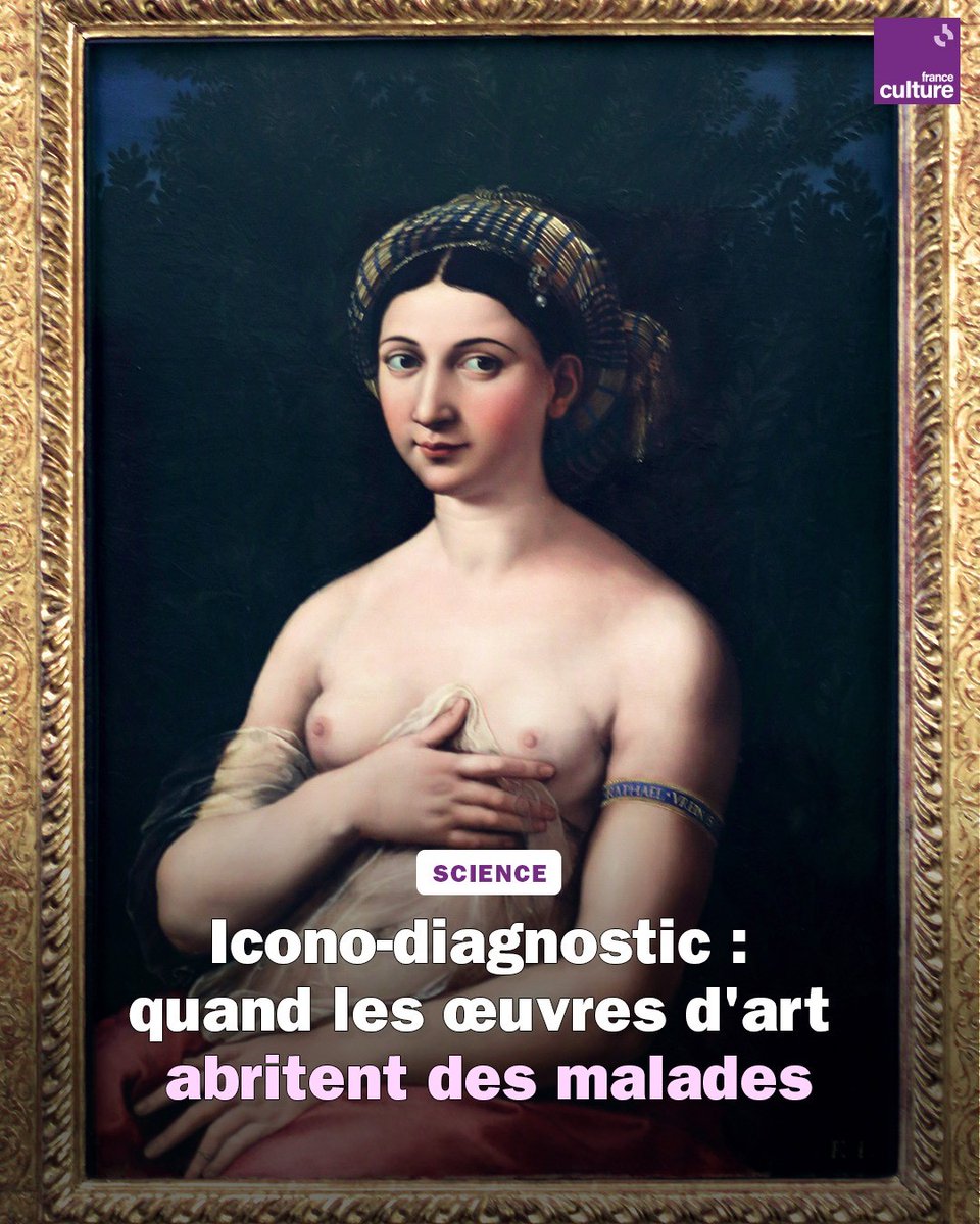 Débusquer les malades dans les œuvres d'art, c'est l'icono-diagnostic ! Sculpture ou peinture, toute figuration humaine peut porter les traces de pathologies. Comment établir correctement ces diagnostics ? avec @doctroptard en (ré)écoute 🖼️👇 bit.ly/3svJsHF #AvecSciences