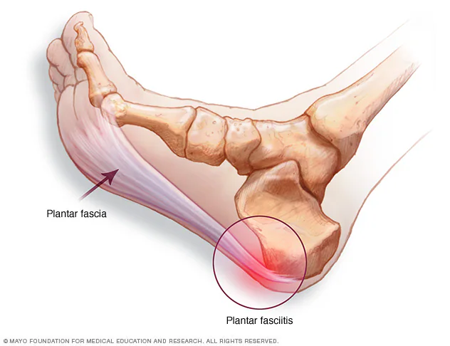 Pain in Lower Leg Above Ankle When Running | Whatcom Physical Therapy