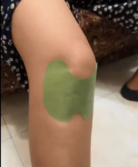 wang_sunny33119's tweet image. Knee patch #kneepatch