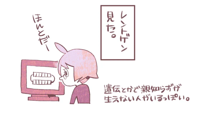 母も親知らずがないらしいので遺伝みたいです。
#日々ぴんりこ 