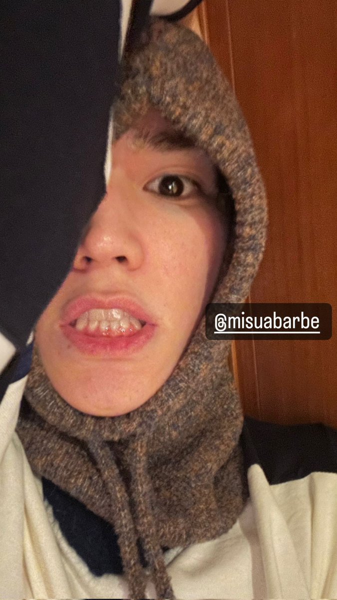 หนูอ้วนแต่งตัวหน้าหนาวน่ารักสุดๆๆ ㅠㅠㅠㅠㅠㅠㅠㅠㅠ