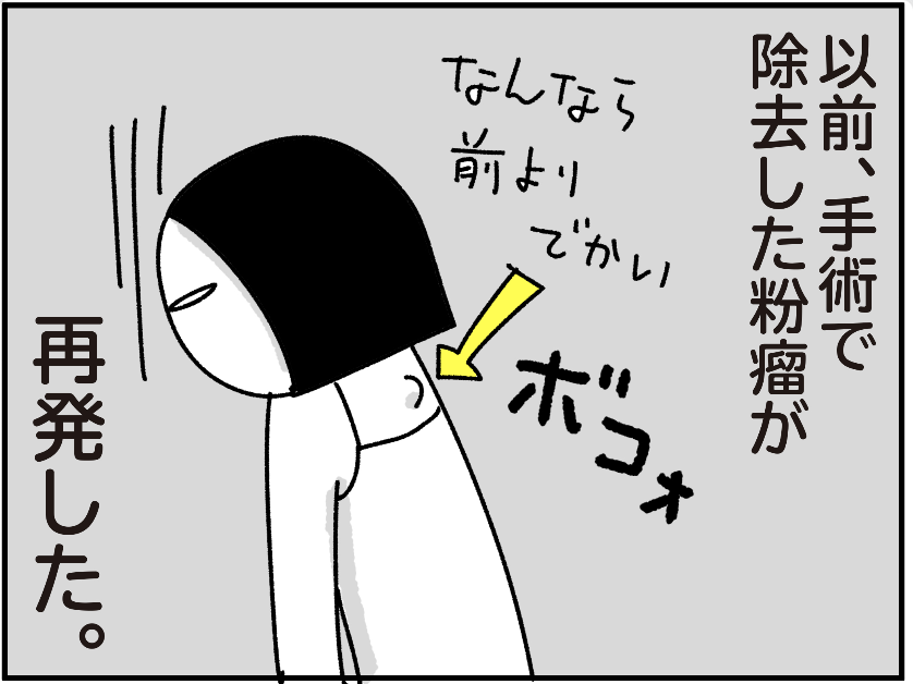 ブログ更新しました。私と粉瘤の何年にもわたる戦い。

粉瘤の話2(前編) - ちょっ子さん https://t.co/8OJqvVrBrM 