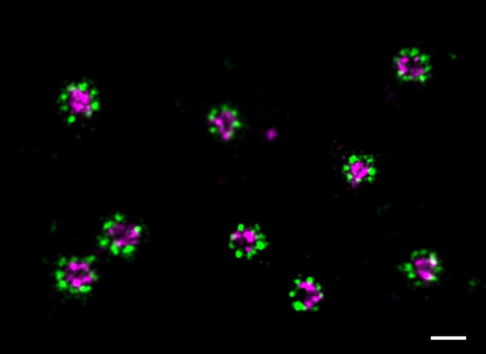 oniHQ's tweet photo. It's #FluorescenceFriday! Here's a beautiful montage of two-color dSTORM images of mEGFP-Nup96 and Nup98 labeled with AZ647 and CF583R using ONI's #DiscoveryKit for dSTORM in cells, and imaged with the #Nanoimager. The scale bar here is 100 nm! #superresolution #microscopy #CODI https://t.co/3v0kp0V3AE