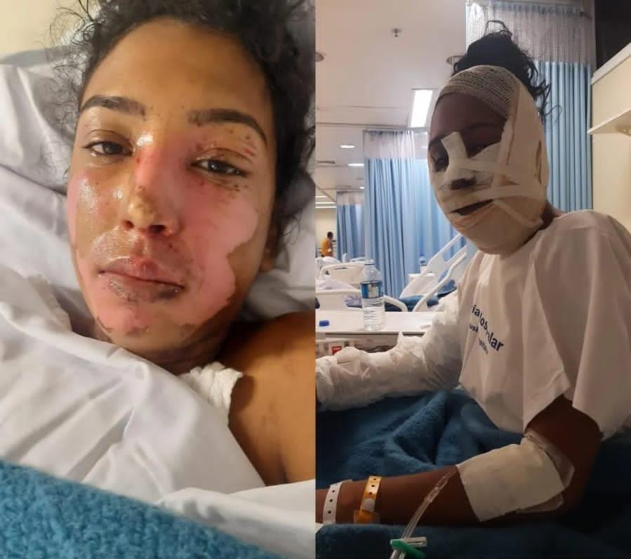 magni3_2's tweet photo. Hoje faz duas semanas desse pesadelo em que minha filha e minha família está vivendo. Pra quem ainda n sabe Emanuelly  Martins tentou matar a minha filha de 17 anos com água fervendo e óleo. Foi tudo planejado desde o início. + https://t.co/Y9s24h8SWu