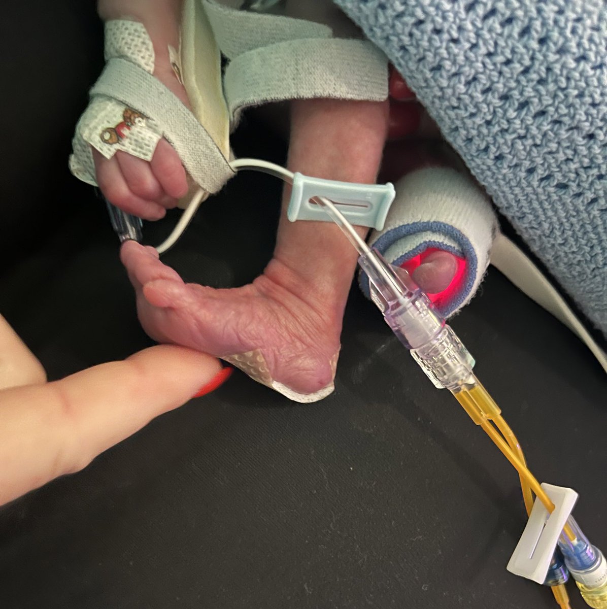 Rhiannon Harries (@rhiharries) on Twitter photo On #WorldPrematurityDay a huge thank you to the obstetric, NICU, paediatric cardiology, surgical & anaesthetic teams at <a href="/CV_UHB/">Cardiff and Vale University Health Board</a> for looking after my brave boy born at 32 weeks in Sept. We received incredible care over the 6 weeks spent on NICU - now enjoying having him home 🩵 On #WorldPrematurityDay a huge thank you to the obstetric, NICU, paediatric cardiology, surgical & anaesthetic teams at <a href="/CV_UHB/">Cardiff and Vale University Health Board</a> for looking after my brave boy born at 32 weeks in Sept. We received incredible care over the 6 weeks spent on NICU - now enjoying having him home 🩵