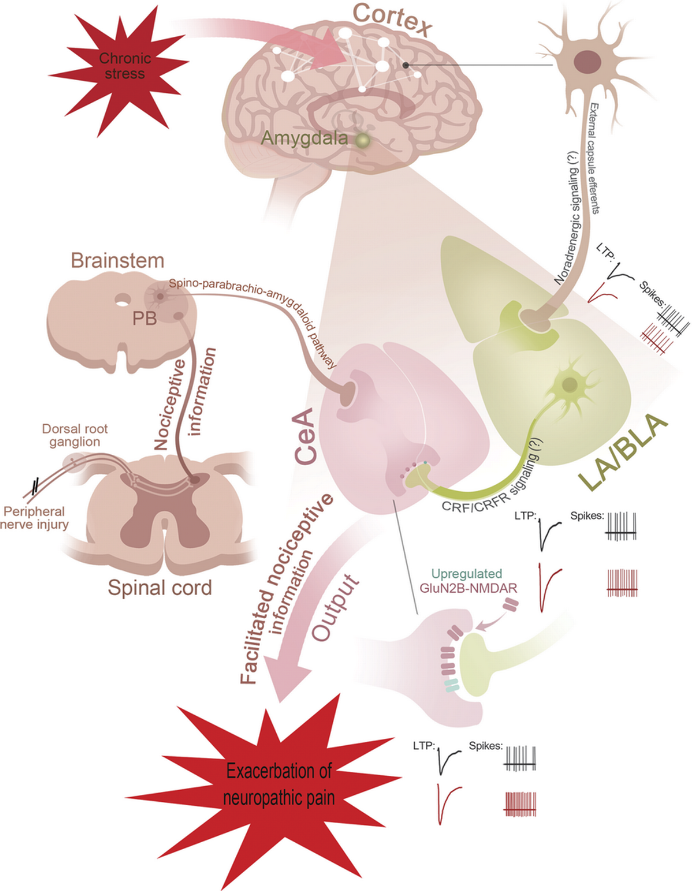 TDekkersPhysio's tweet photo. Can stress increase neuropathic pain?YES

Here's the physiology 👇

Stress...
1️⃣ Activates noradrenergic &amp; corticotropin-releasing factor (CRF) signaling
2️⃣ Upregulates NMDA receptors +🔼 sensitization of the amygdala 

= Neuropathic pain exacerbation

https://t.co/roA8IfJaLC https://t.co/VORdjZAC7f