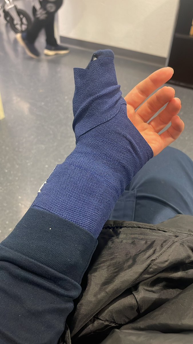 After I had to het stiches on my thumb, I have now torn the tendon in my thumb.. lucky me 3 months at home but wont be able to game … 🤮😭😭