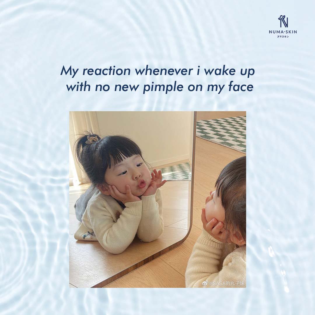 thenumaskin's tweet photo. Wajah sore yang bebas jerawat, semangat hari ini! 🌞🙌 
Setiap kali aku terbangun tidur siang dan melihat kulitku jernih tanpa jerawat baru, rasanya seperti kemenangan kecil sendiri. Mari hadapi hari ini dengan percaya diri dan kulit yang sehat! 💪✨ #ClearSkinJoy #Numaskincare https://t.co/liEqIHzlT4