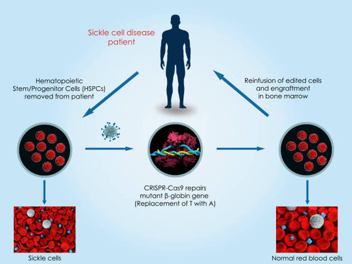 Extraordinaria noticia!!
Se aprueba el primer fármaco de edición genética (CRISPR) del mundo en Reino Unido. Se trata de un tratamiento frente a la anemia de células falciformes y la β-talasemia dependiente de transfusión para pacientes de 12 años o más.
nature.com/articles/d4158…