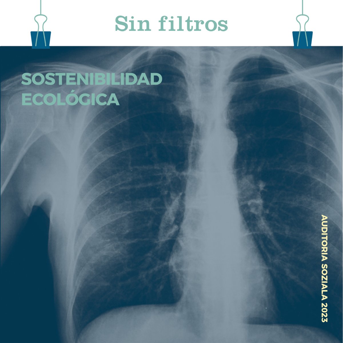 REASEuskadi's tweet photo. 🌿 En la ESS, nuestros pulmones son la sostenibilidad. Estamos respirando un aire más limpio y construyendo un futuro más verde. 🌱💪

🩻 La radiografía completa la puedes encontrar aquí: https://t.co/J5GzCitHt7

#SinFiltros https://t.co/ci6Oemw9ir