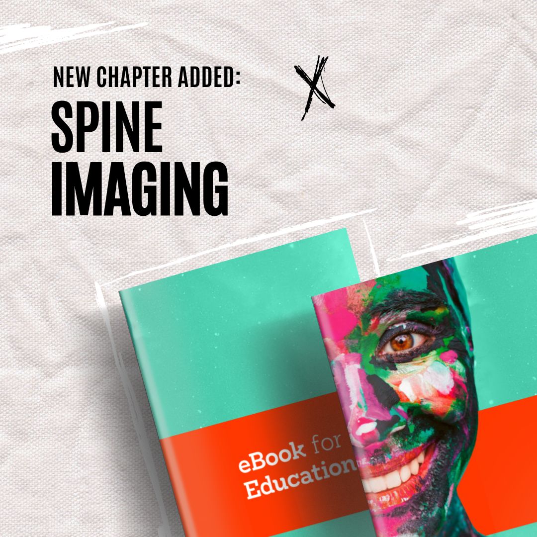 Unlock the latest chapter in our FREE eBook for Undergraduate Education in Radiology! 🌟 Immerse yourself in the world of 'Spine Imaging' with insights from top European experts! Ready to elevate your understanding of spine imaging? 🚀 Visit buff.ly/3PQzfNn for your copy