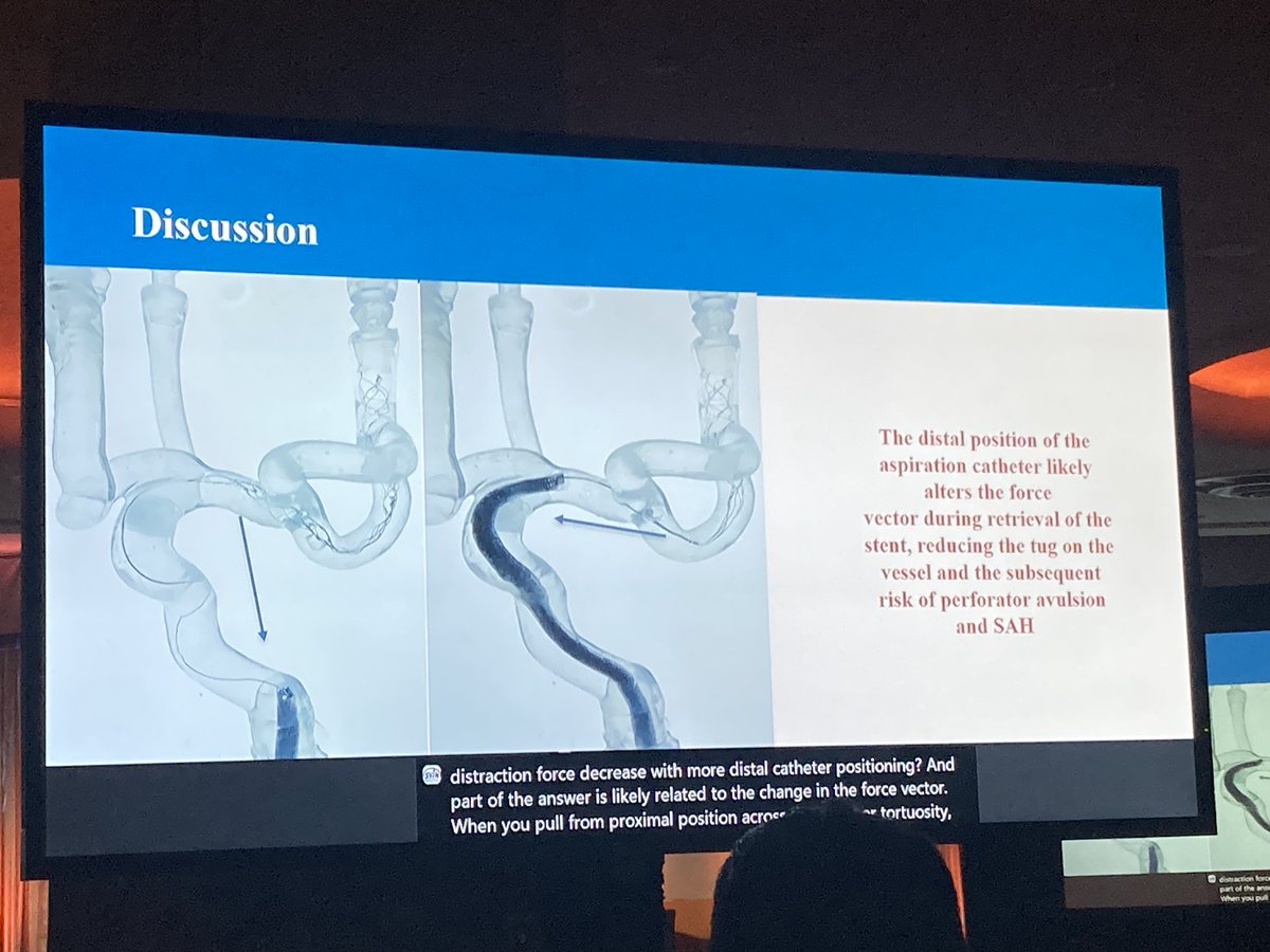 Stroke: Vascular and Interventional Neurology (@svinjournal) on Twitter photo How to choose the appropriate thrombectomy technique? Particularly for more distal occlusions? <a href="/AmirMMolaie/">Amir Molaie</a> from <a href="/UCLANeurology/">UCLA Neurology</a> presents in vitro data to help improve safety #SVIN2023 <a href="/KeikoFukudaMD/">Keiko Fukuda</a> How to choose the appropriate thrombectomy technique? Particularly for more distal occlusions? <a href="/AmirMMolaie/">Amir Molaie</a> from <a href="/UCLANeurology/">UCLA Neurology</a> presents in vitro data to help improve safety #SVIN2023 <a href="/KeikoFukudaMD/">Keiko Fukuda</a>