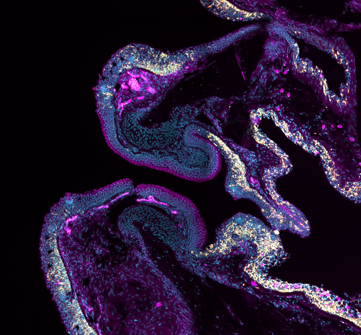 #FluorescenceFriday Adult zebrafish mouth - T/NK cells (ZAP70 yellow), Sagital cryosection. Whereas these immune cells are abundant within the squamous epithelia lining the oral mucosa and the skin, they are absent from the keratinized epithelium lining the lips of the fish.…